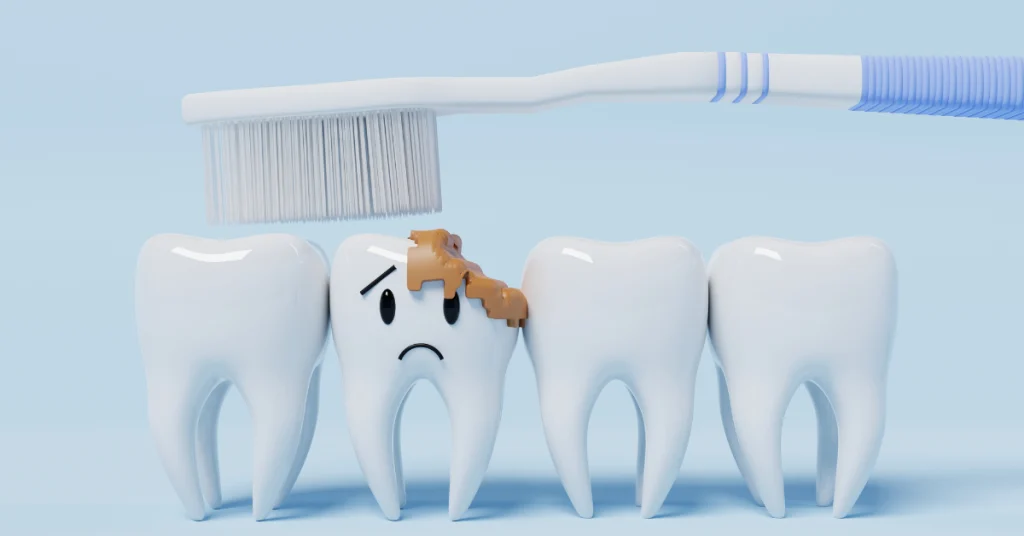 Carie, le domande più comuni per affrontare e risolvere il problema con tranquillità