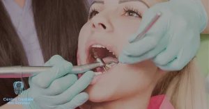 Ablazione del tartaro: le domande più comuni